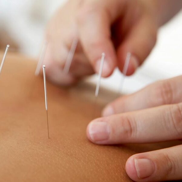 Advanced Acupuncture Center