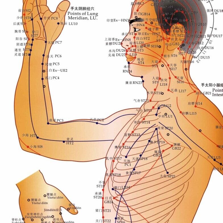 A man with acupuncture points on his body.